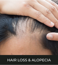 PRP Therapy,laser hair removal in Gurugram - Alovia Skin Clinic